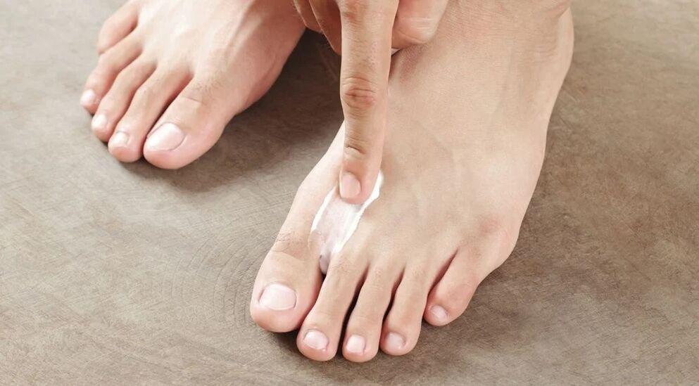 Applying the cream from the fungus between the fingers
