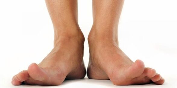fungus on feet