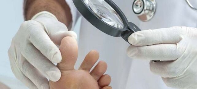 Examinations before starting fungal treatment